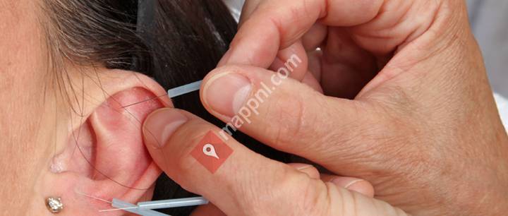 Acupunctuurpraktijk Bolck