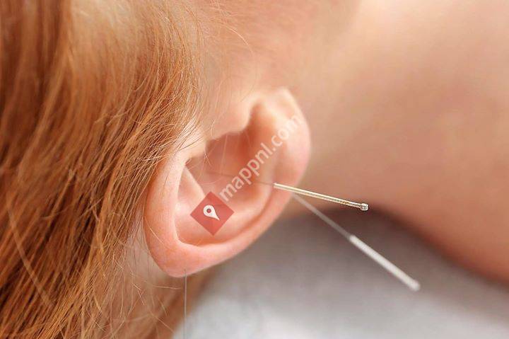 Praktijk voor Acupunctuur Ammerlaan